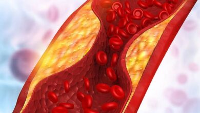 triglycerides