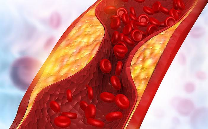 triglycerides